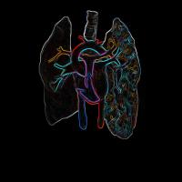 A coeur ouvert
