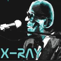 X-Ray